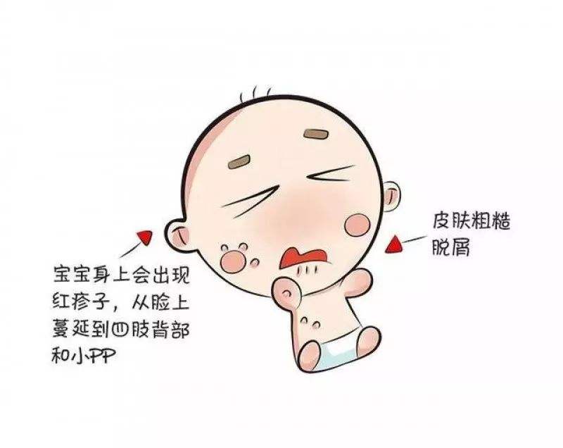 患上了湿疹应该怎么诊断