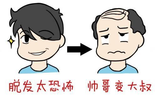 头部脱发如何护理